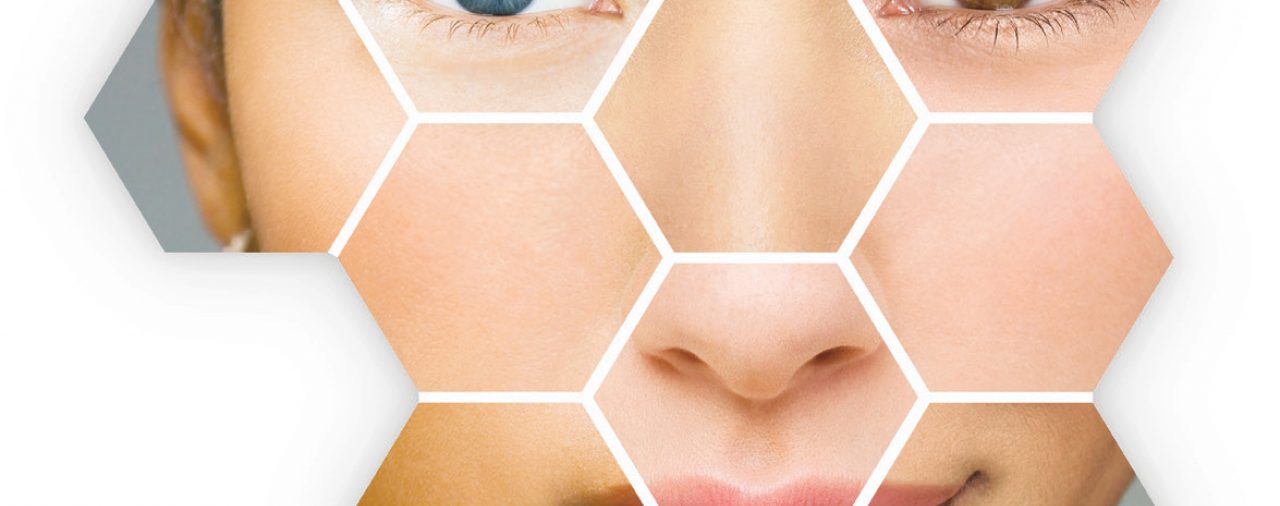 Lees deze blog van Marloes bij Sense huidverbetering!