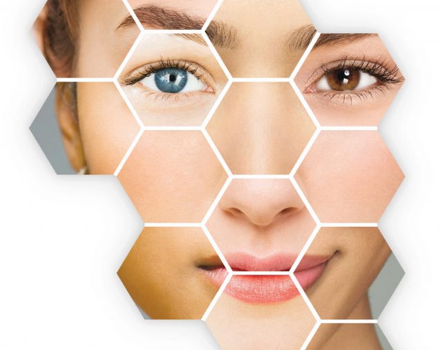 Lees deze blog van Marloes bij Sense huidverbetering!